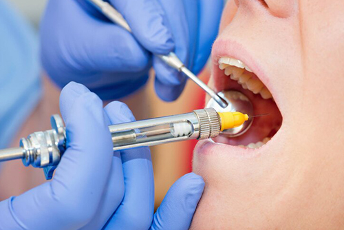 mex medical servicios ENDODONCIA