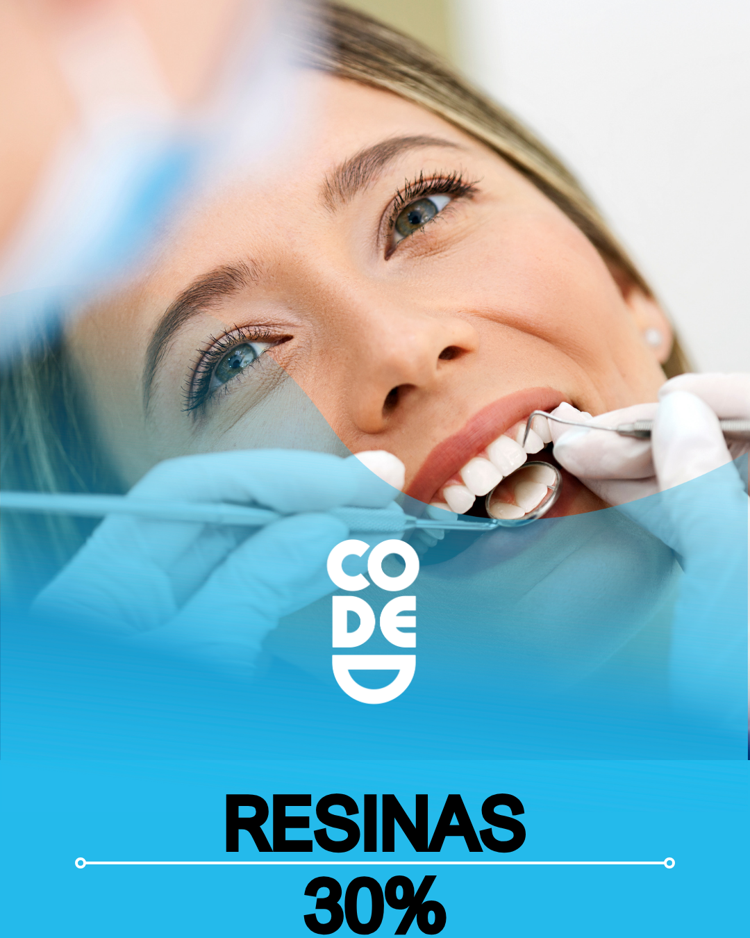 Resinas menos el 30%